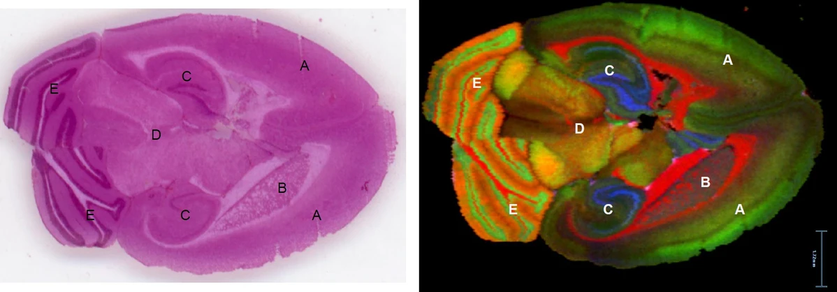 Waters Corporation: SELECT SERIES MRT DESI Imaging - H&E stained brain section and MS image