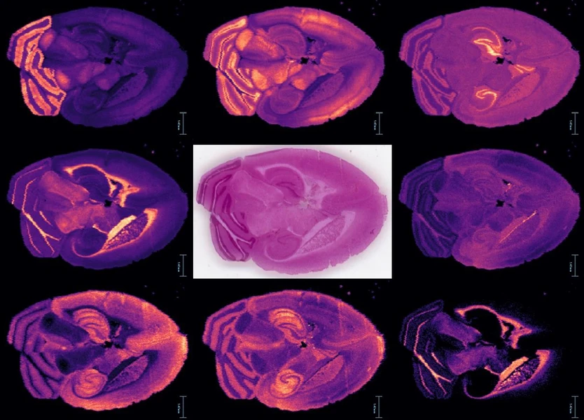 Waters Corporation: SELECT SERIES MRT DESI Imaging - Selected mouse brain lipids acquired at 50 μm spatial resolution