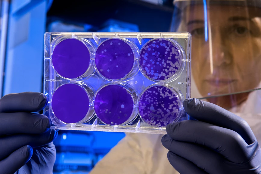 <p>Unsplash/CDC: Identifikace bakterií plynovou chromatografií Agilent 7890B</p>
